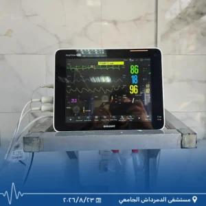 شاشة مراقبة العلامات الحيوية بقسم الأعصاب بمستشفى الدمرداش